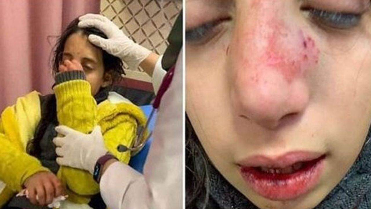 Fanatik Yahudiler Filistinli kız çocuğunu önce darp etti, sonra kaçırmaya çalıştı!