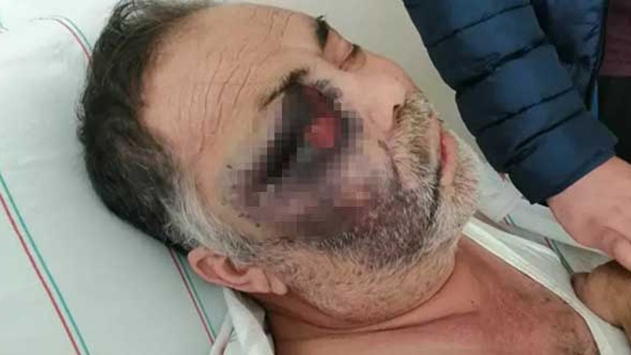 Baba ve oğlu tarafından darbedilen yüzde 90 engelli Mümün Kara hayatını kaybetti