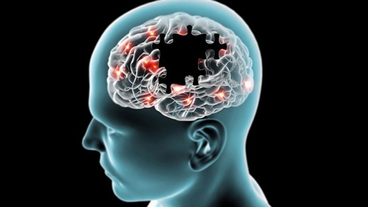 Bilim insanlarından büyük başarı! Yazılardan 'Alzheimer' olup olmadığınızı anlıyor...