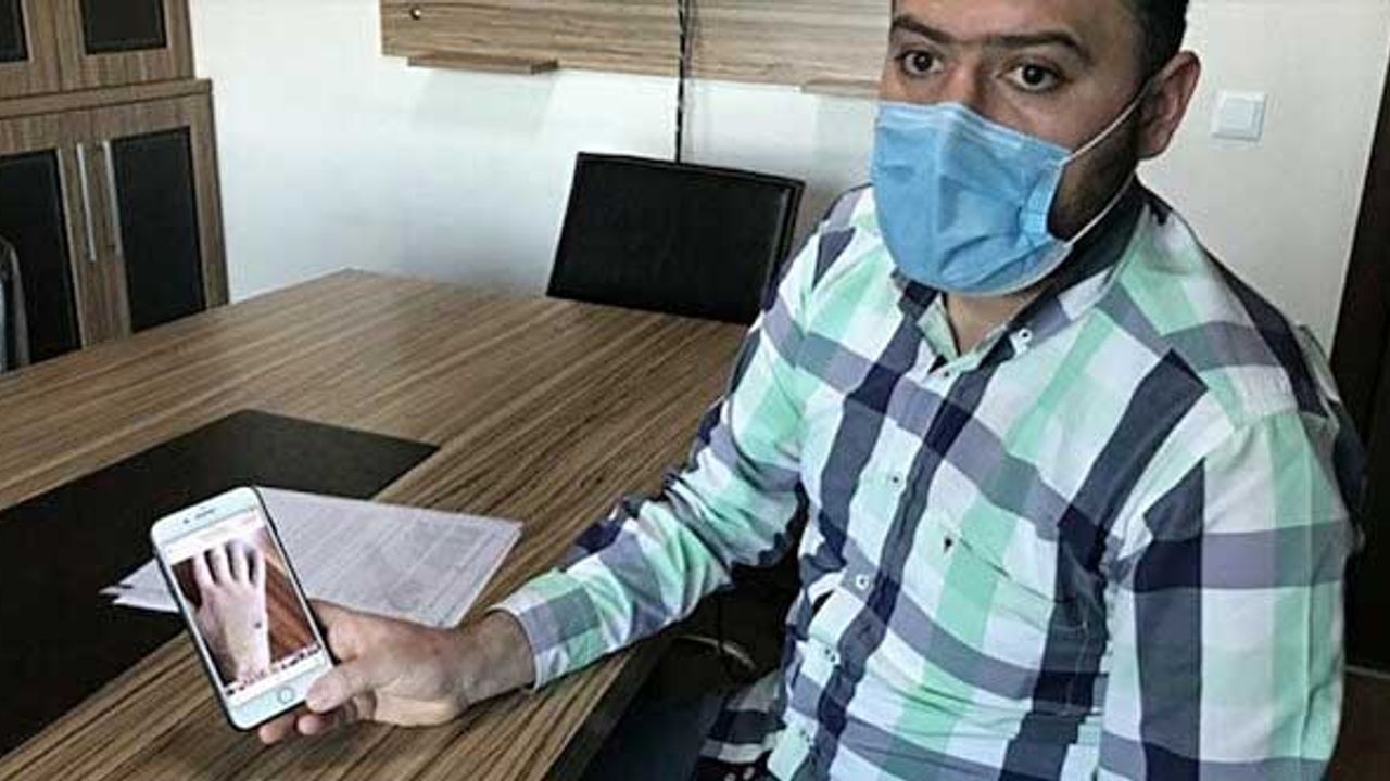 Kuduz köpeğin ısırdığı vatandaşa belediye tazminat ödeyecek