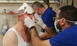 Selçuk Özdağ'a saldıran iki kişi gözaltına alındı