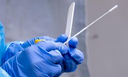 PCR testi yaptırmak istemeyenler işten çıkarılabilecek mi?